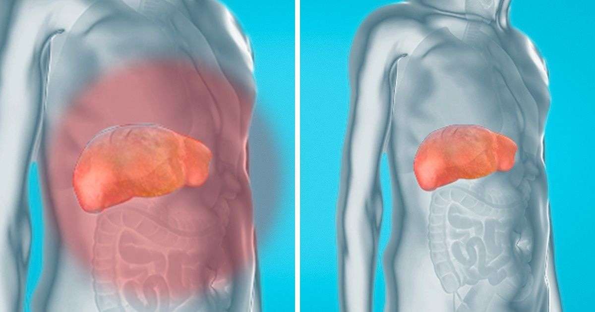 How to Remove Toxins From Your Liver, Kidneys, and Bladder ...