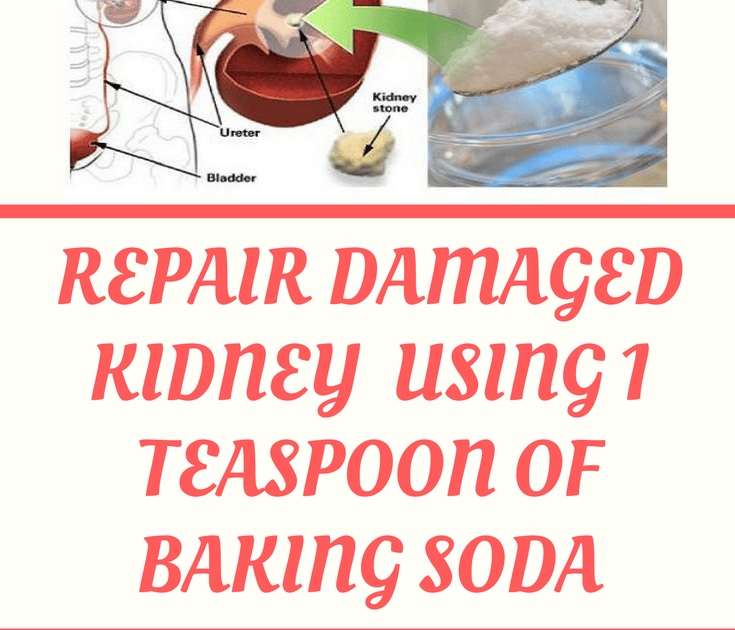 How To Repair Your Damaged Kidney Naturally Using 1 Teaspoon Of Baking ...