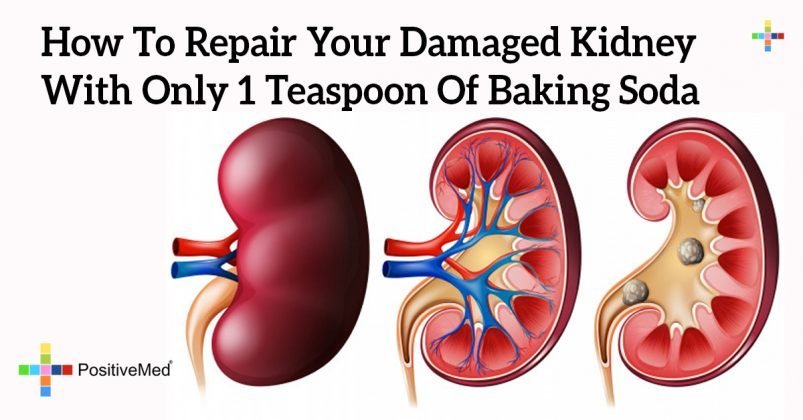 How To Repair Your Damaged Kidney With Only 1 Teaspoon Of ...