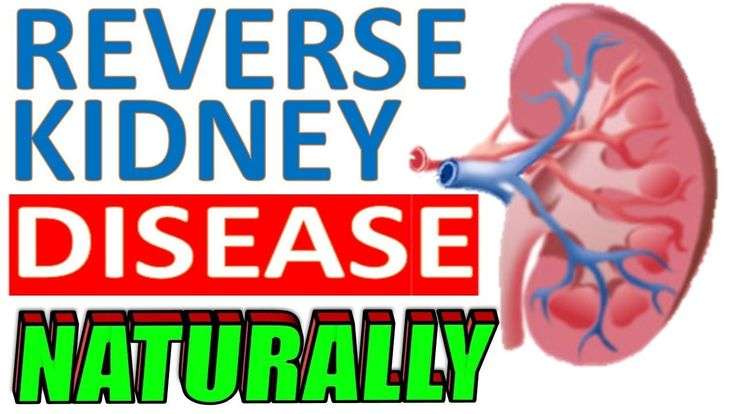 How to Reverse Kidney Disease Naturally &  Improve Kidney ...