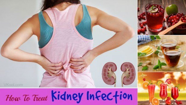 How to treat kidney infection naturally at home â 15 tips