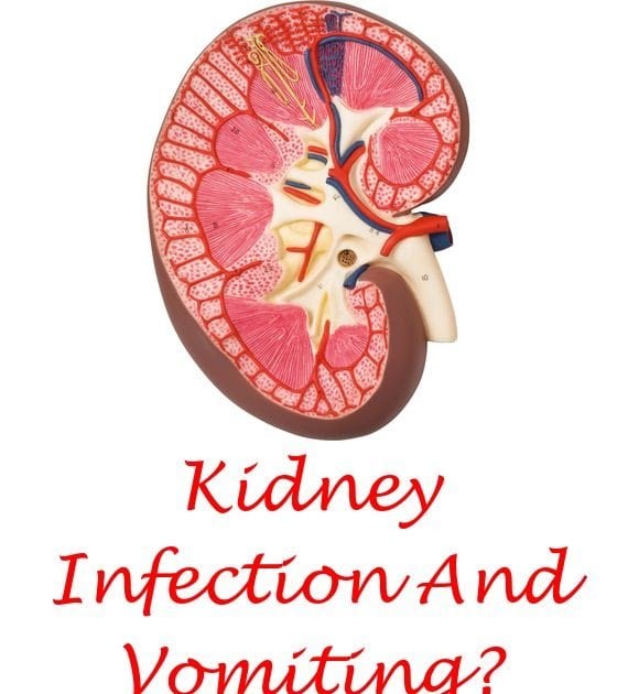 How To Treat Kidney Stones Nhs