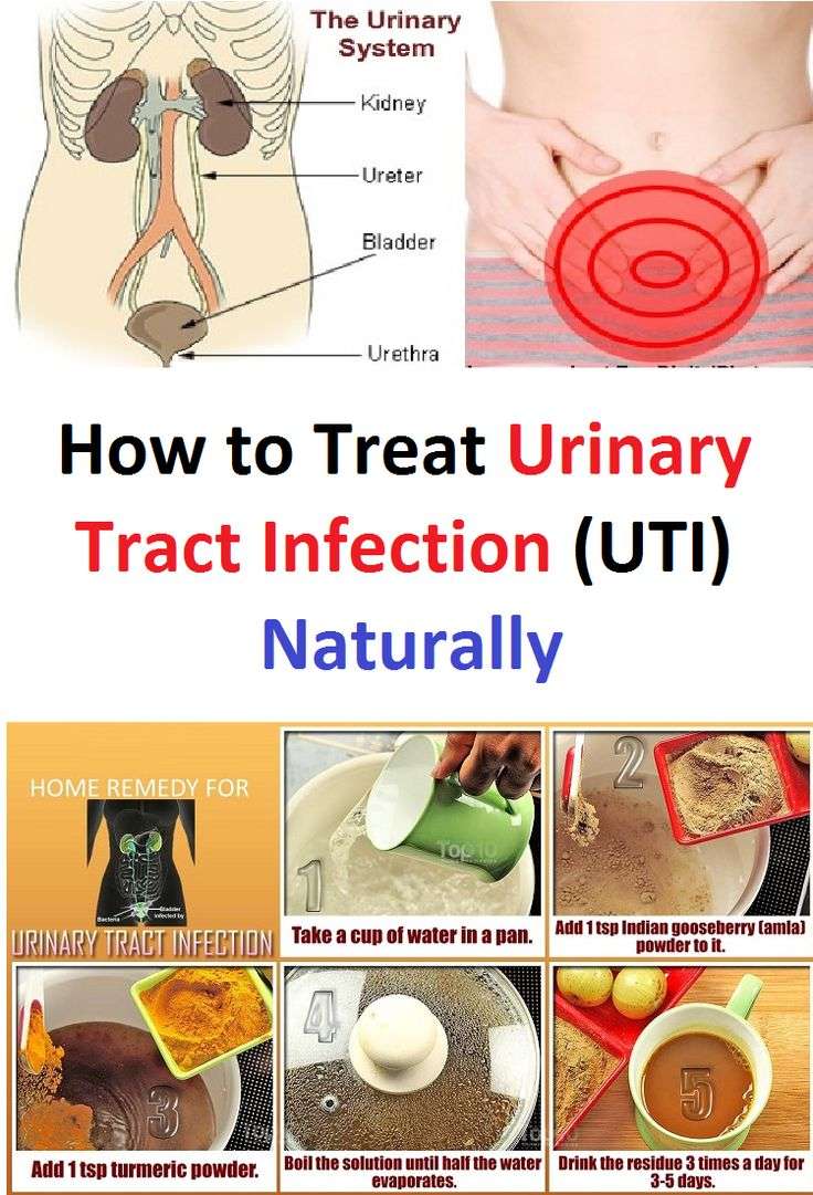 How to Treat Urinary Tract Infection (UTI) Naturally ...