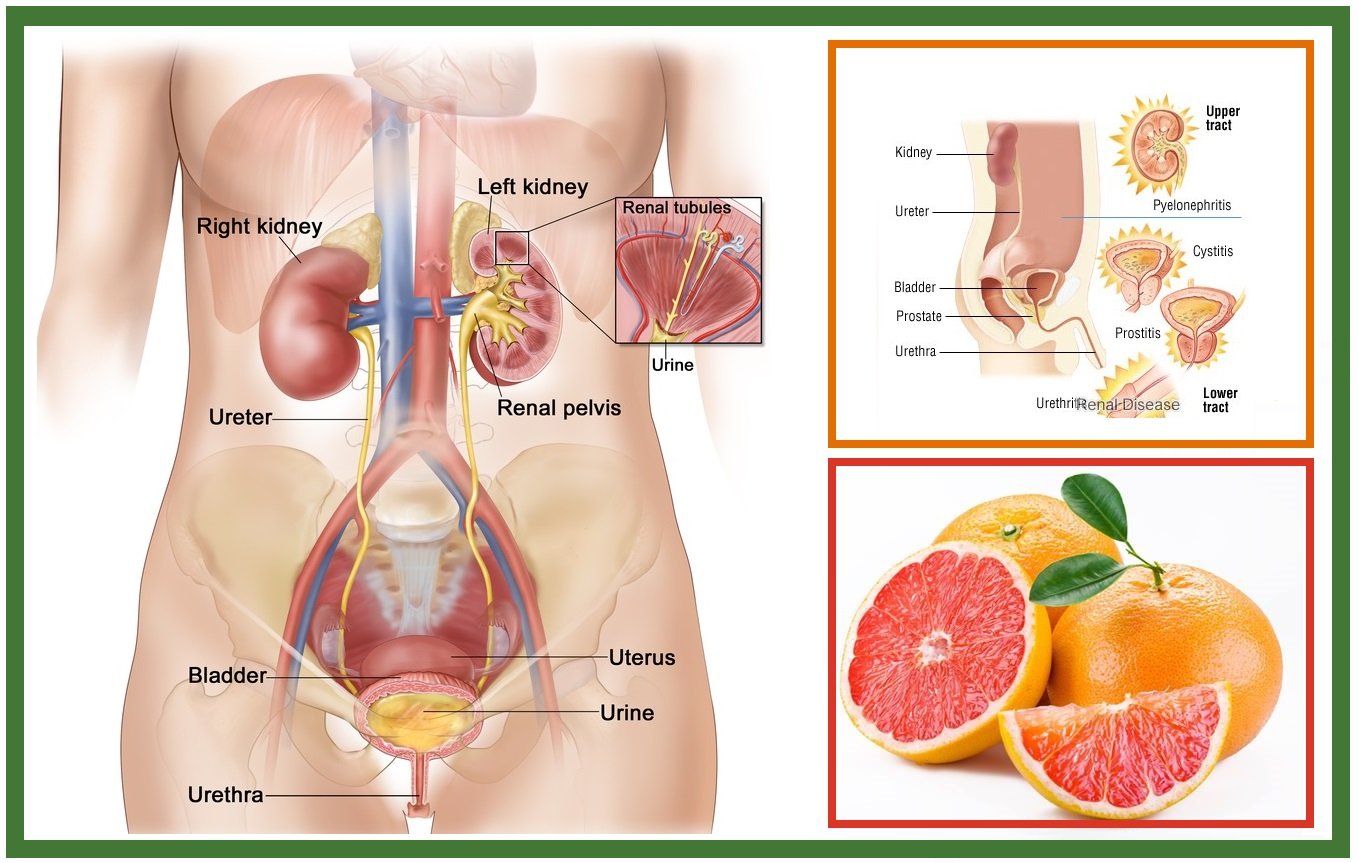 How to Treat Urinary Tract Infections at Home Using Grapefruit Seeds ...
