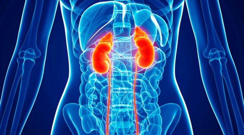Human Kidney: infections, stones, and embolization ...