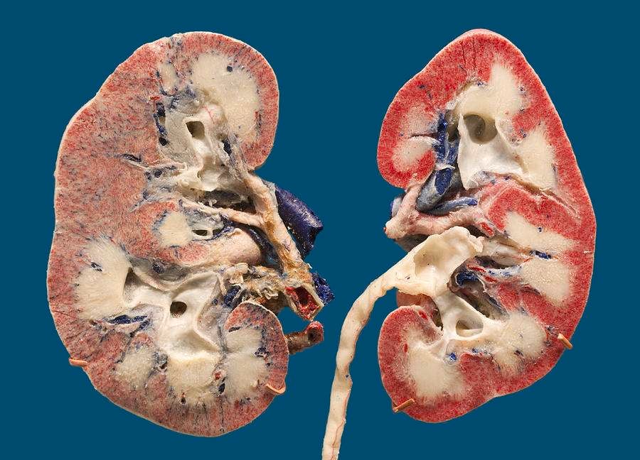 Human Kidney Sections Plastinated Photograph by Science Stock Photography