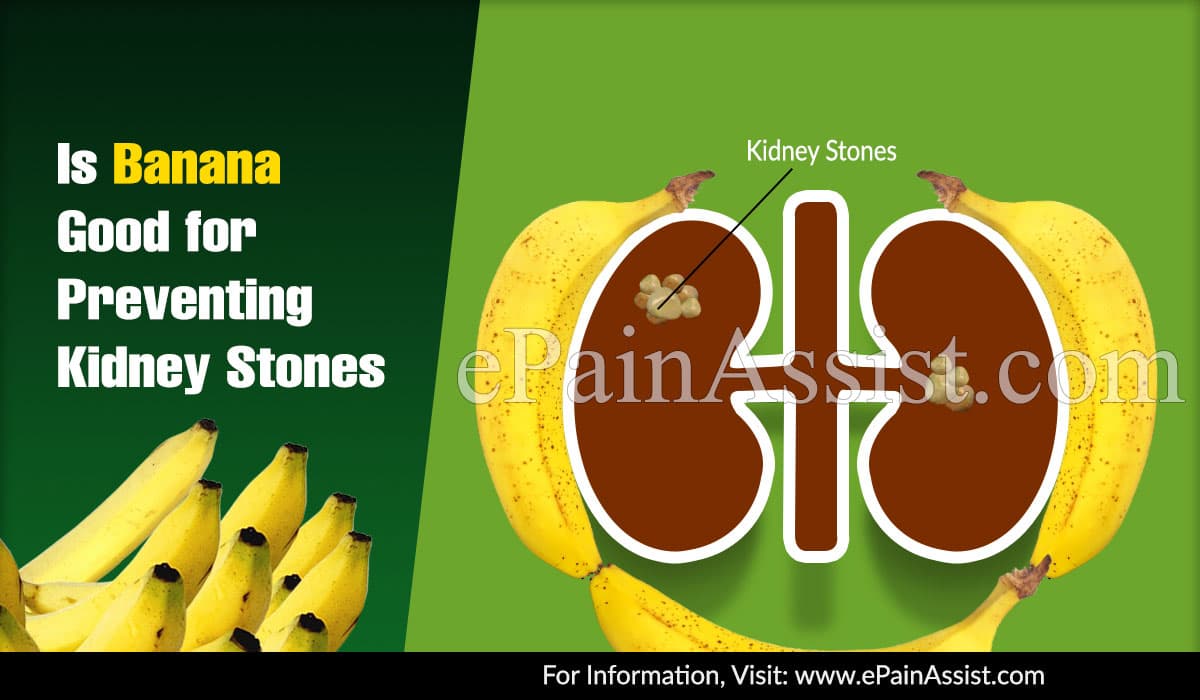 Is Banana Good for Preventing Kidney Stones?