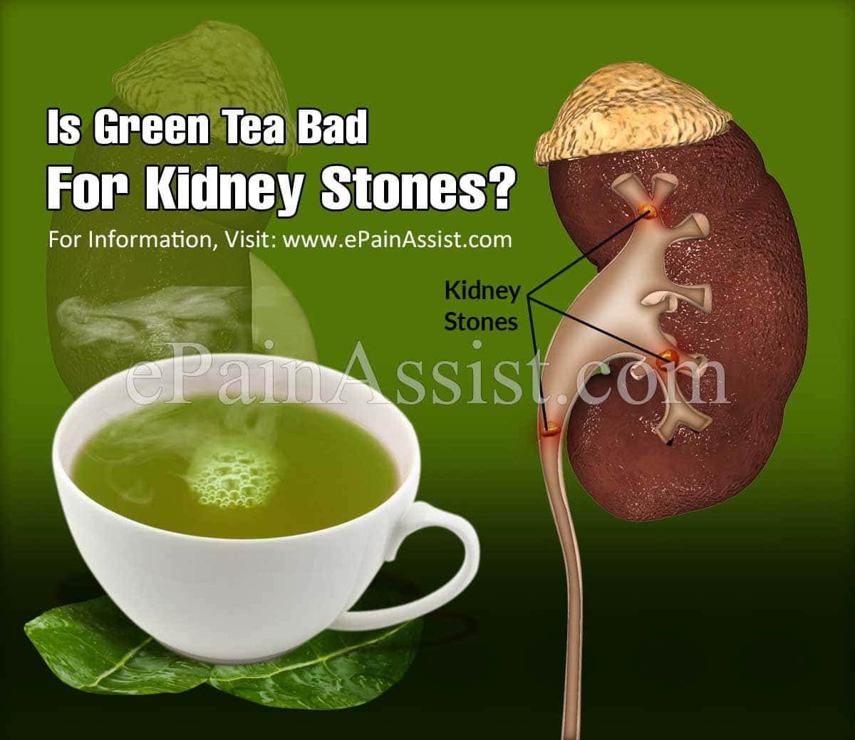 Is Green Tea Bad for Kidney Stones?