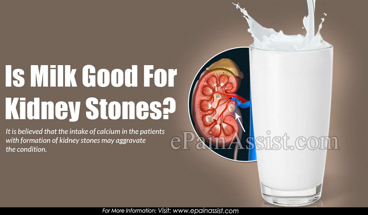 Is Milk Good for Kidney Stones?