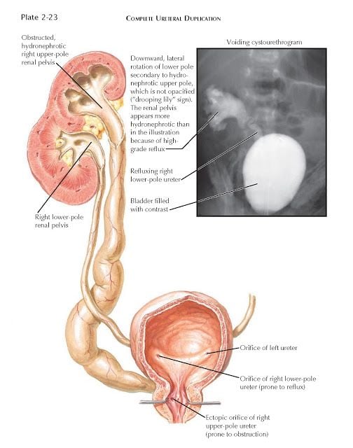 Kidney Anatomy Lower Pole