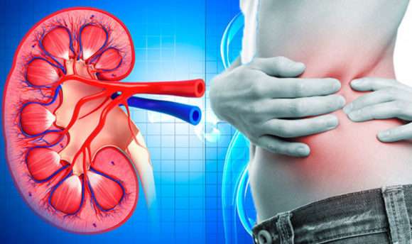 Kidney Cancer: Know more about it !!