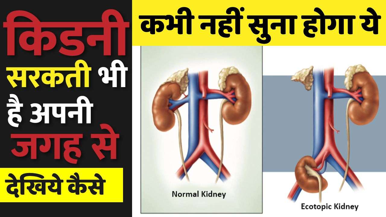 Kidney Dialysis In Hindi Meaning