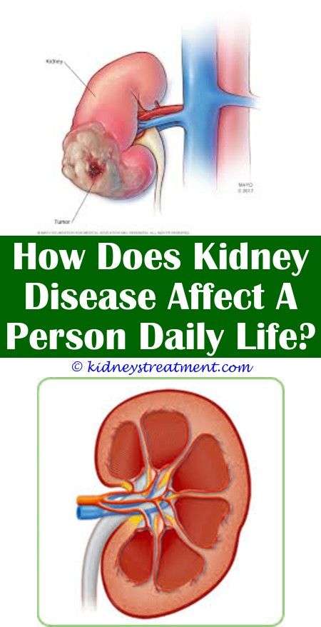 Kidney Disease Level 3a