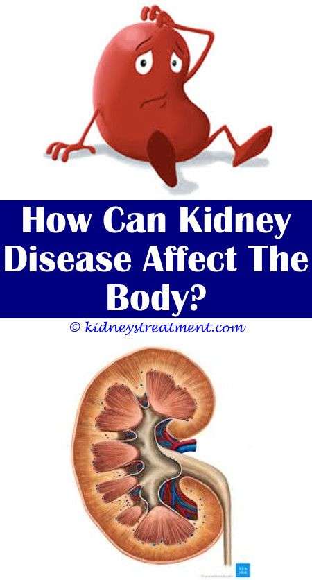 Kidney Disease Quotes Products
