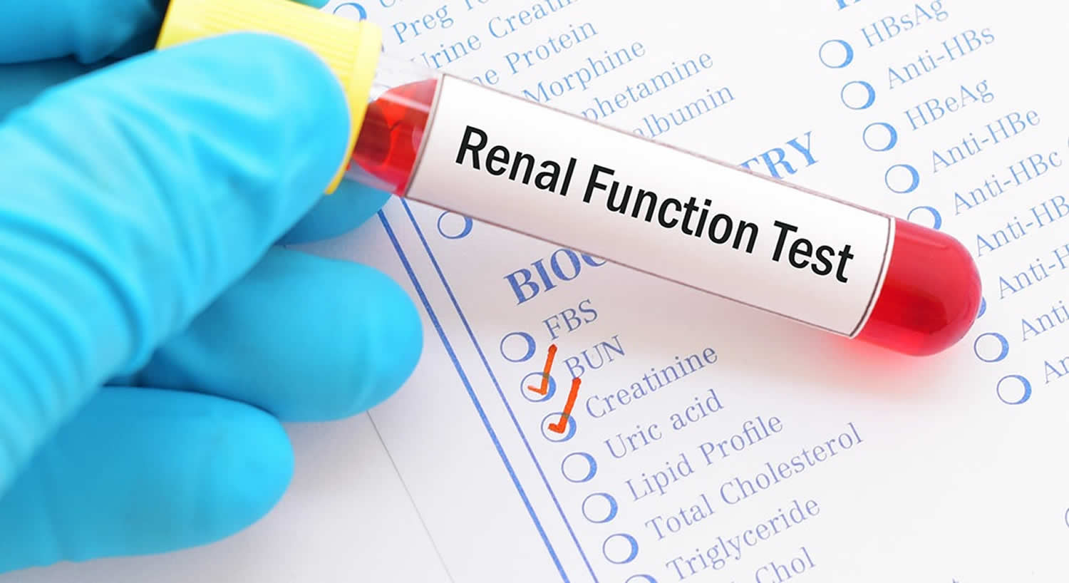 Kidney Function Test and Kidney Function Test Results ...