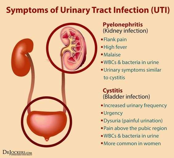 Kidney Infection From Untreated Uti