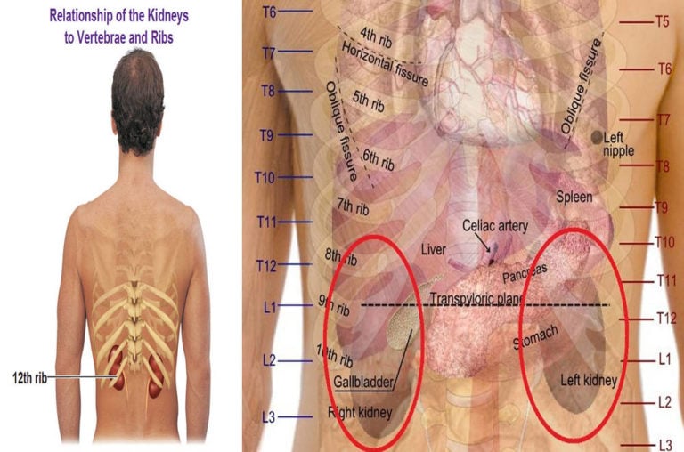 Kidney Pain : Location, Pictures, Symptoms, Causes ...