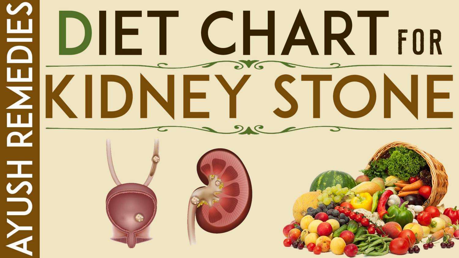 Kidney Stone Diet, List of Foods to Eat and Avoid During Kidney Stones ...