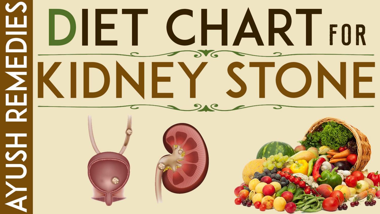 Kidney Stone Diet, List of Foods to Eat and Avoid During ...