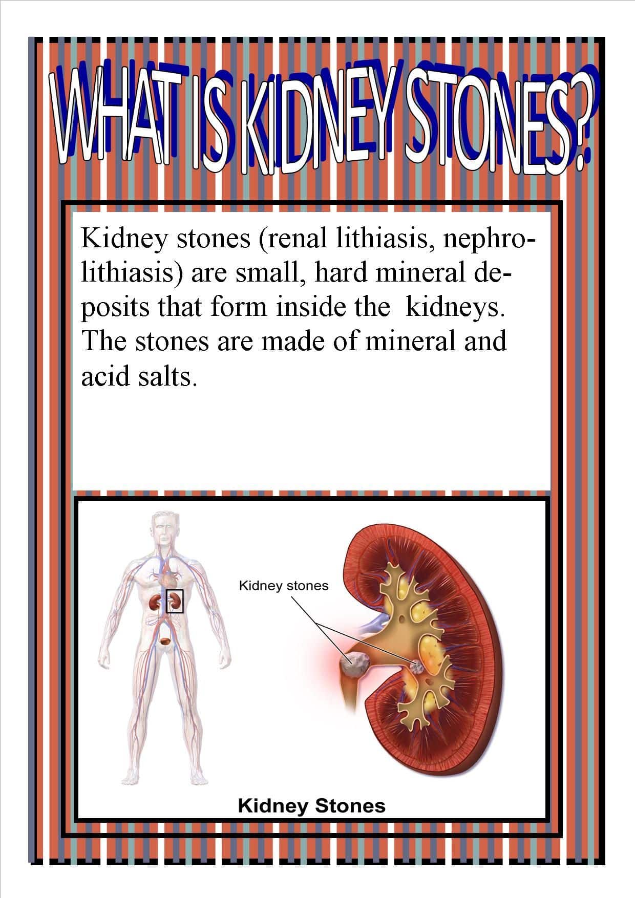 Kidney Stone Removal Medical Term