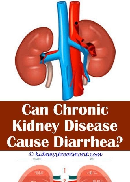 Kidney Stone Symptoms Cause Diarrhea