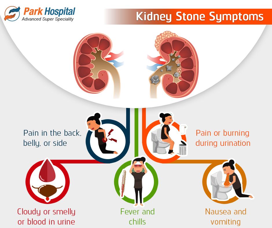 Kidney stones are sometimes left unnoticed. Know these ...