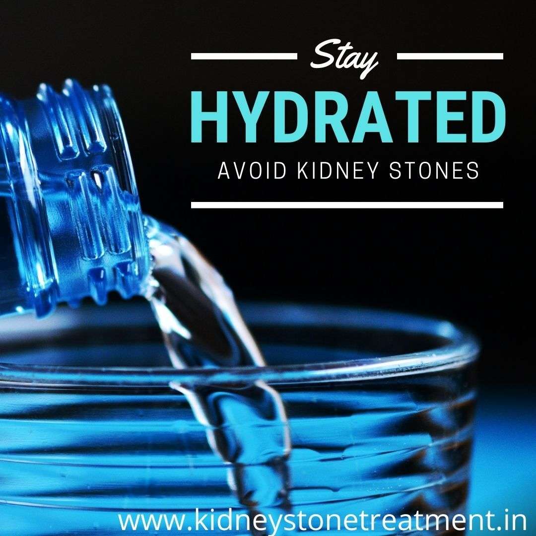 Kidney Stones But Drink Lots Of Water