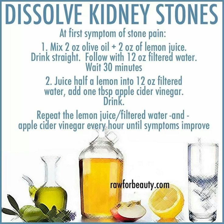 Kidney stones dissolve
