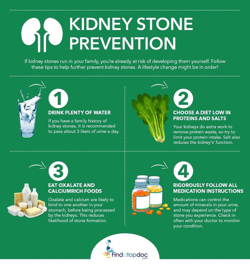 Kidney Stones: Symptoms, Causes, Treatment, and Diagnosis ...