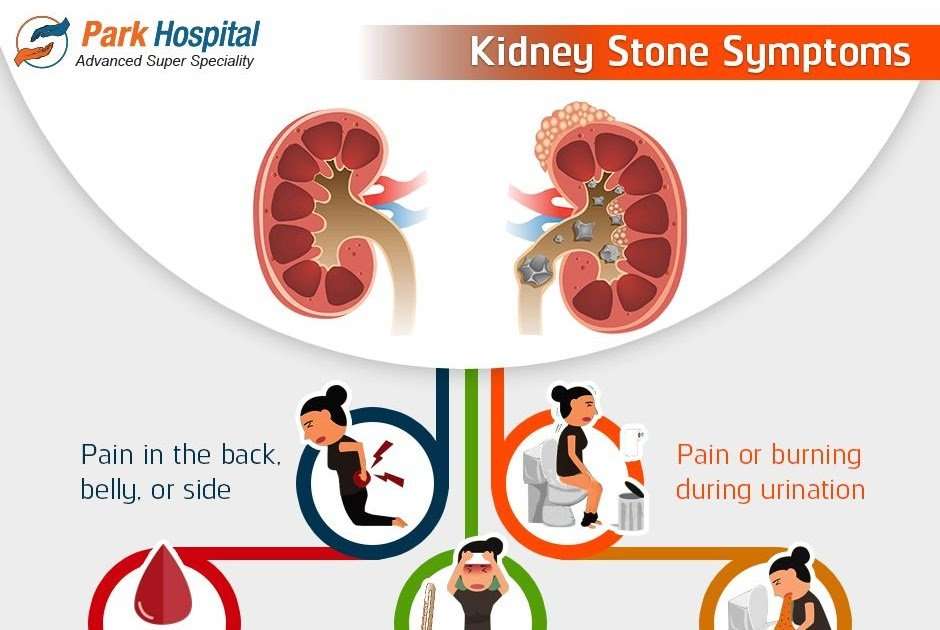 Kidney Stones Symptoms Vomiting