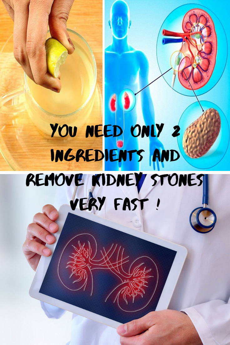Kidney Stones Urine Female Blood Clots In Urine