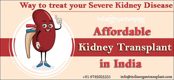 Kidney Transplant Cost How Much