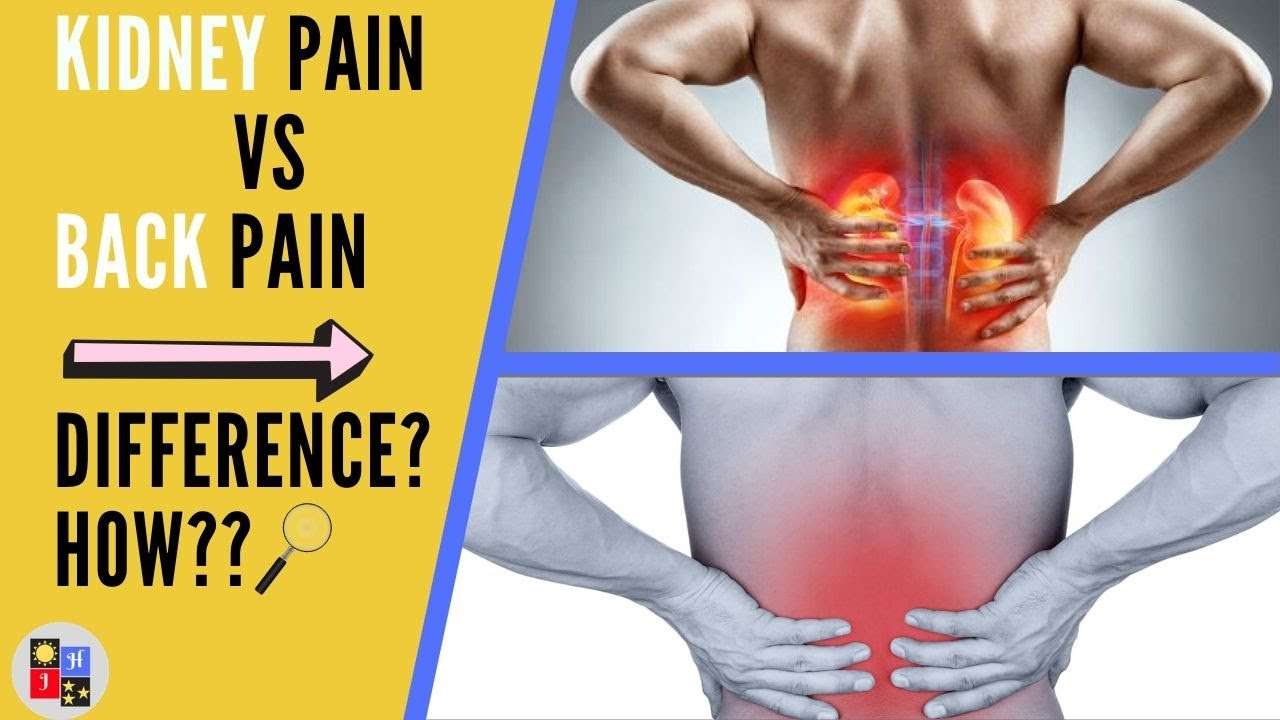 Low Back Pain or Kidney Pain?