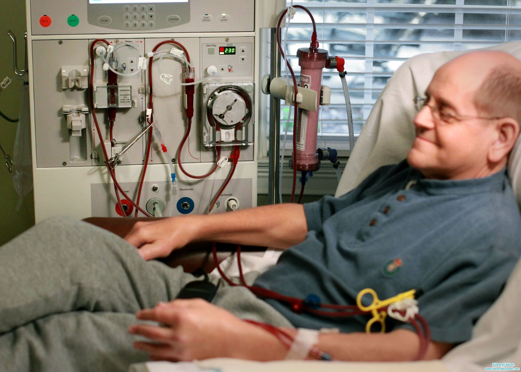 Patients Have No Bowel Movement after Dialysis in Kidney ...