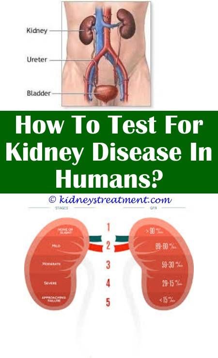 Pin by Cherie Bailey on Kidneys in 2020