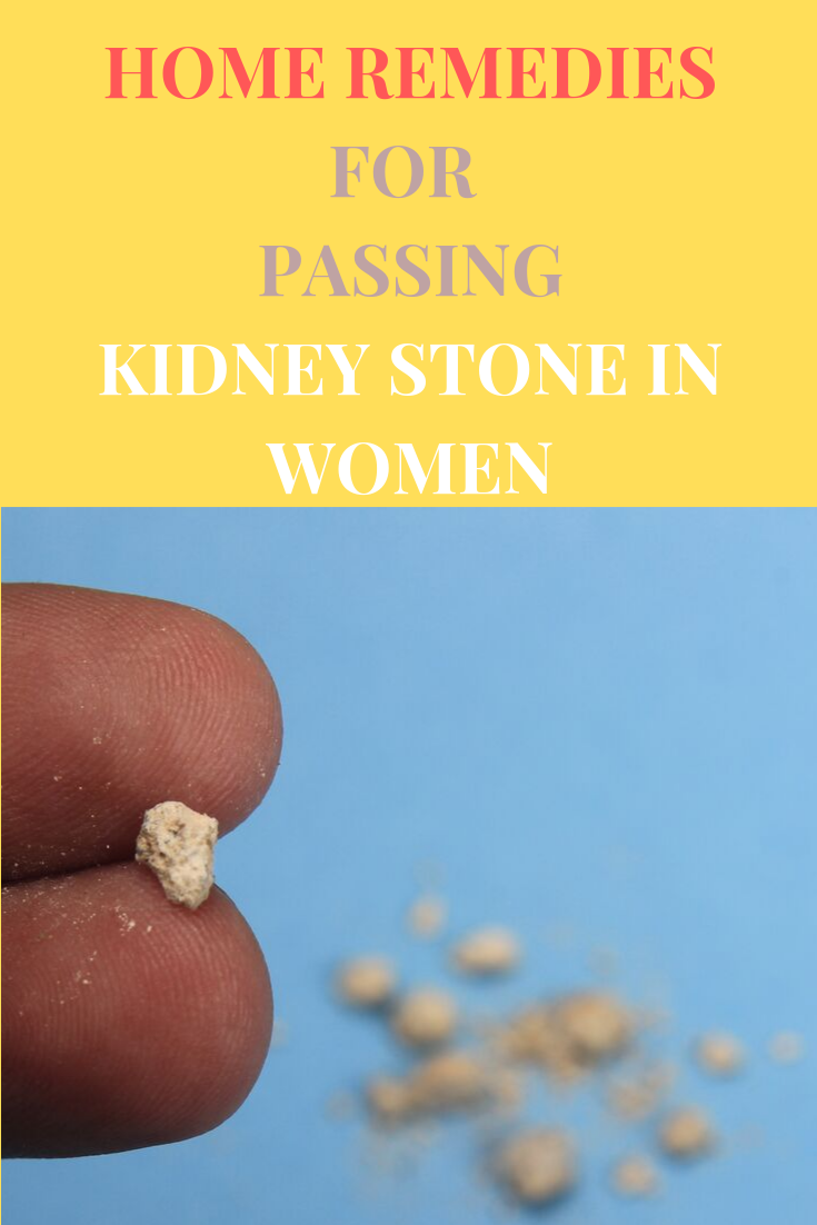 Pin on Kidney Stones in Women