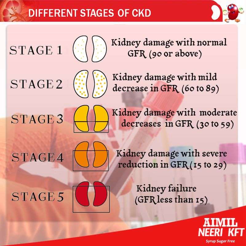Stages of chronic #Kidney #Disease (#CKD) are determined by ...