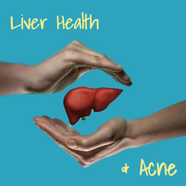 Support Your Liver to Clear Acne