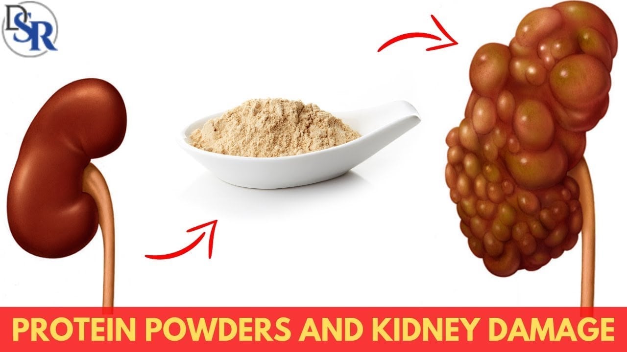 The Real Truth About Protein Powders And Kidney Damage