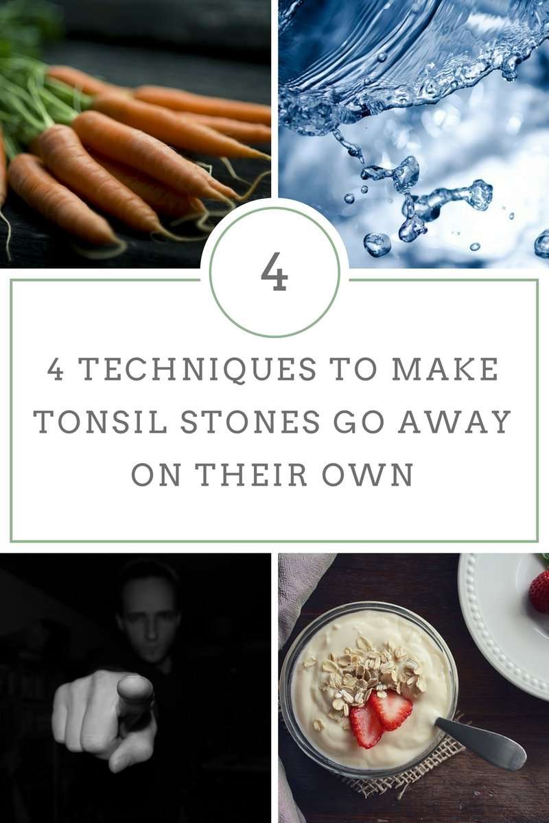 The truth: Do tonsil stones go away on their own?