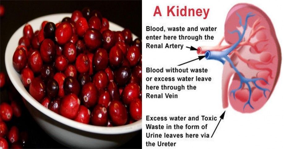 These 14 Foods Will Improve Your Kidneys