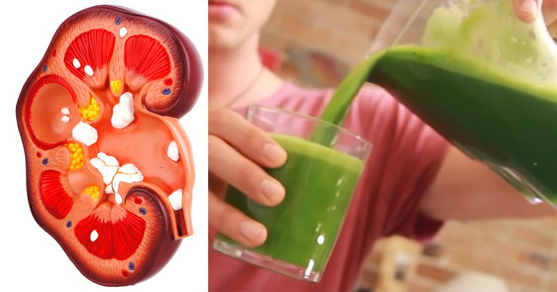 This Homemade Drink Cleanses The Kidneys Completely And ...