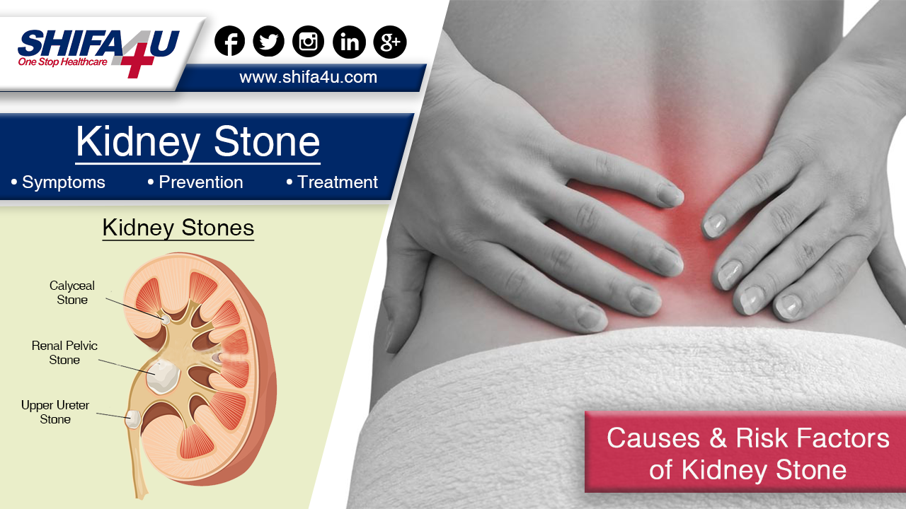 Understanding How Can I Stop Kidney Pain For Your ...