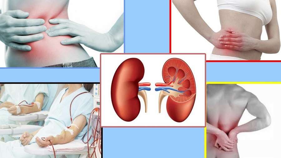 Wellness Tips: 8 Outstanding Symptoms Of Kidney Failure You Need To ...