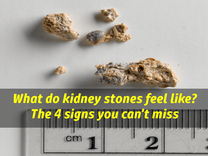 What do kidney stones feel like? Signs of kidney stones ...
