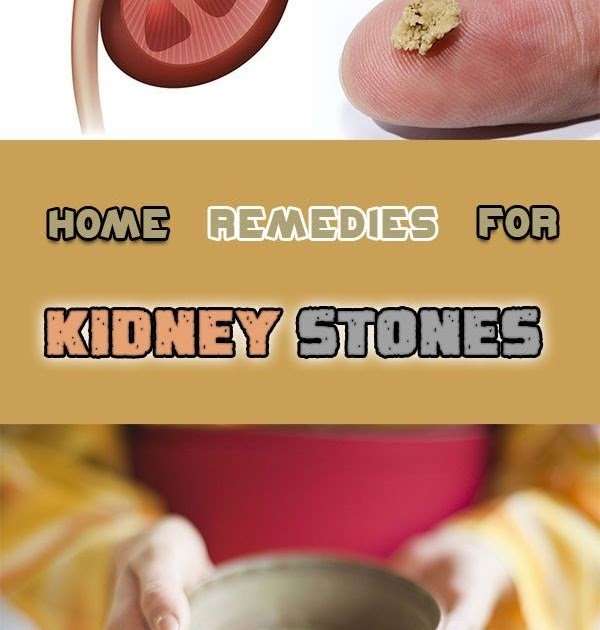 What Do Kidney Stones Look Like When They Come Out