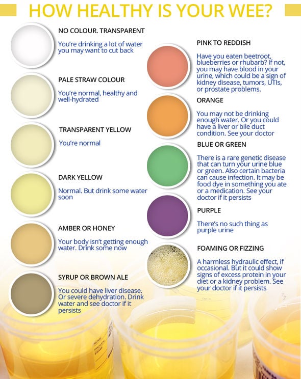 What does your urine colour mean? Brown wee could be a ...