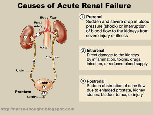 What is Acute Kidney Failure (renal failure)