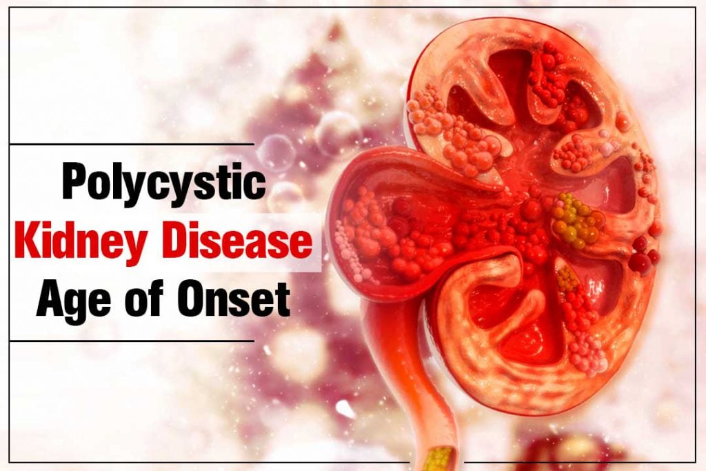 What is polycystic kidney disease age of onset?