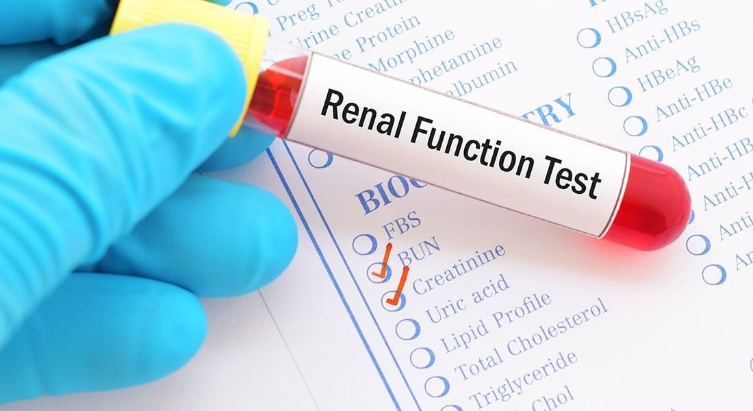 What, Why, and How of a Kidney Function Test